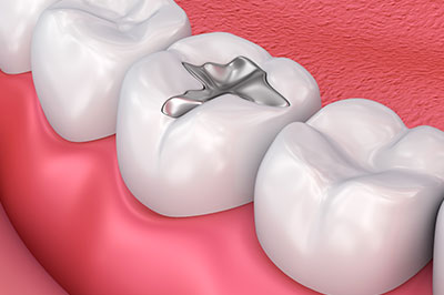 McGregor Dental at McGregor Point | Preventative Program, Dental Bridges and Periodontal Treatment