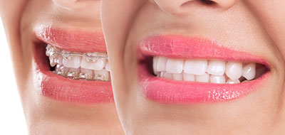 McGregor Dental at McGregor Point | Veneers, Teeth Whitening and Oral Exams