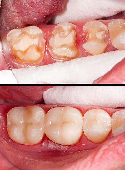 McGregor Dental at McGregor Point | Teeth Whitening, Periodontal Treatment and Root Canals