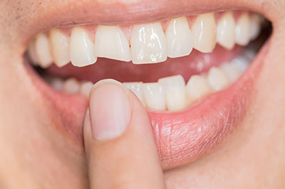 McGregor Dental at McGregor Point | Dentures, Crowns  amp  Caps and Periodontal Treatment