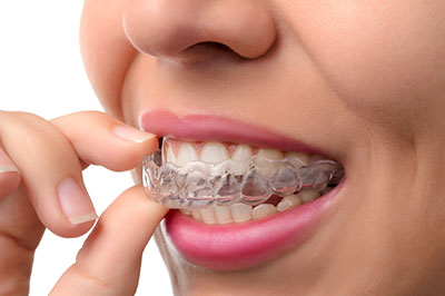 McGregor Dental at McGregor Point | Teeth Whitening, Veneers and Dentures