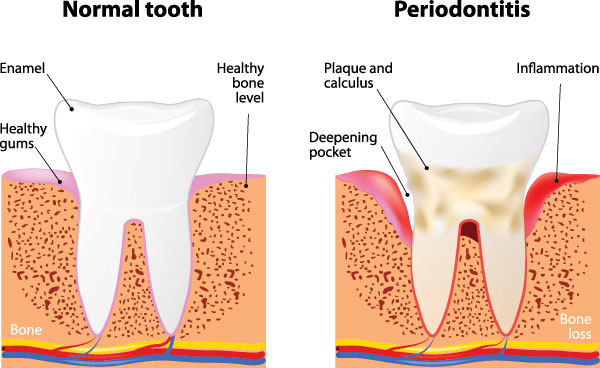 McGregor Dental at McGregor Point | Dental Fillings, Pediatric Dentistry and Implant Restoration