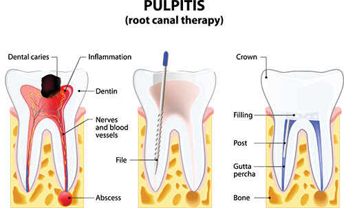 McGregor Dental at McGregor Point | Oral Exams, Dental Fillings and Implant Restoration