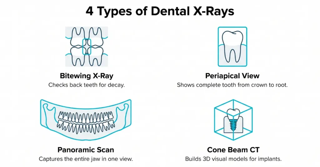 Infographic highlighting are dental x-rays safe alongside the four primary types of dental X-rays.